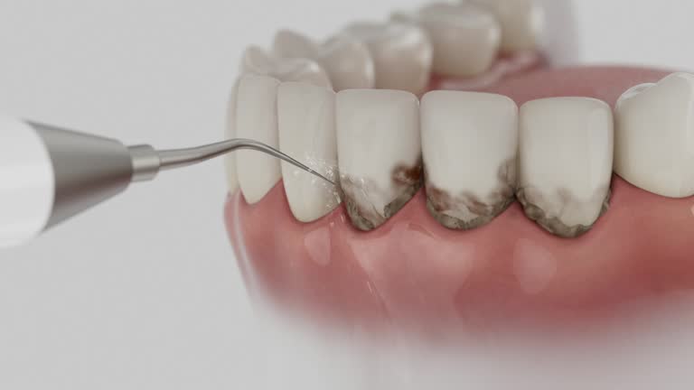 Trusted Root Canal Treatment service in Bryn Mawr-Skyway, WA - Dentist Open Now